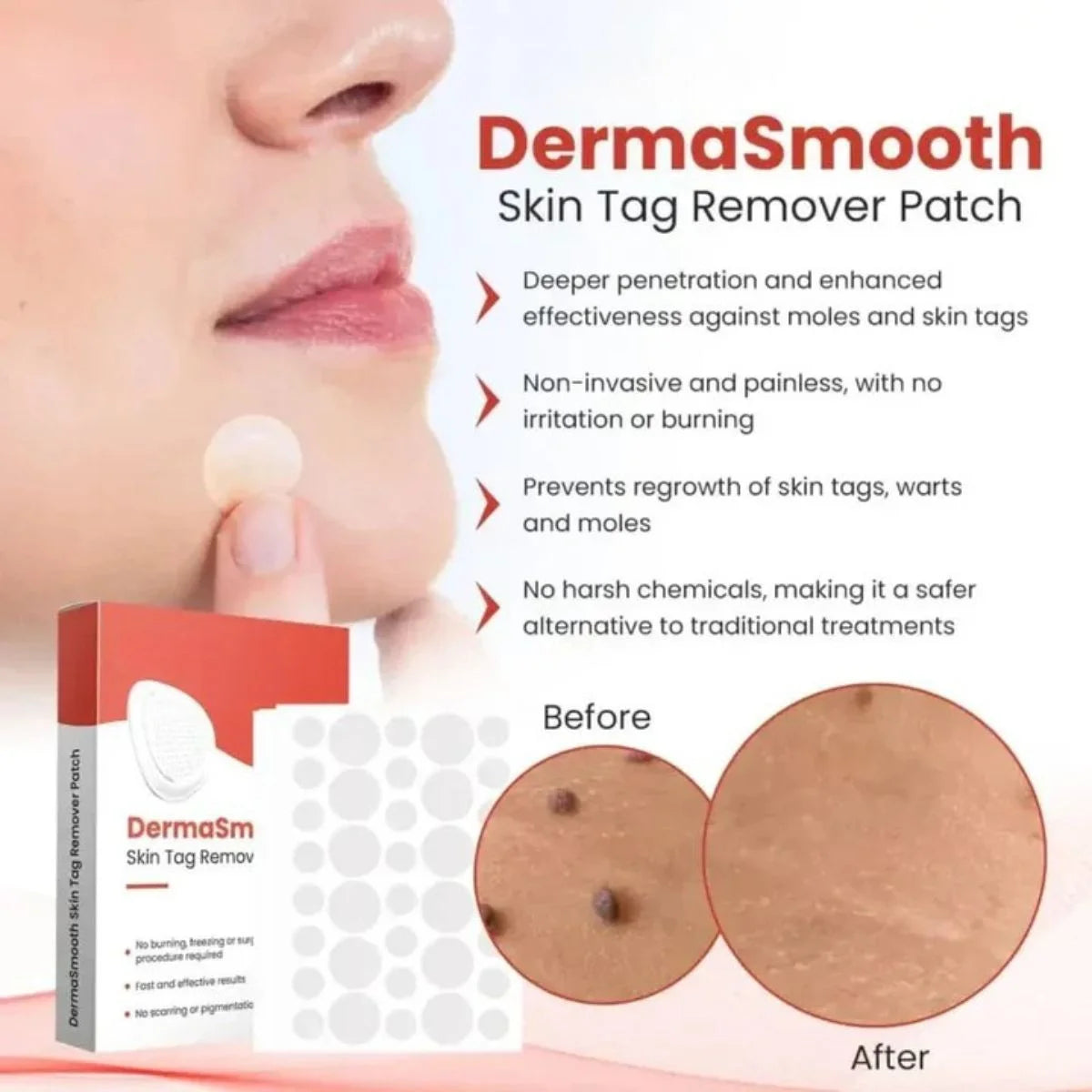 DermaSmooth Skin Tag Remover Patch |  Fast, Safe & Painless Skin Tag & Mole Removal | Nano-Microneedle Technology | 72 Patches